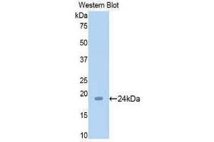 Western Blotting (WB) image for anti-Sirtuin 5 (SIRT5) (AA 48-244) antibody (ABIN1176396) (SIRT5 抗体  (AA 48-244))