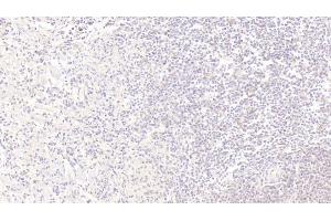 Detection of IGFBP1 in Human Spleen Tissue using Monoclonal Antibody to Insulin Like Growth Factor Binding Protein 1 (IGFBP1) (IGFBPI 抗体  (AA 36-235))
