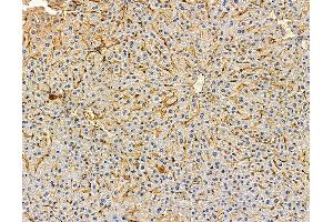 ABIN7095992 and ABIN7100054 at 1/100 staining mouse liver tissue by IHC-P.
