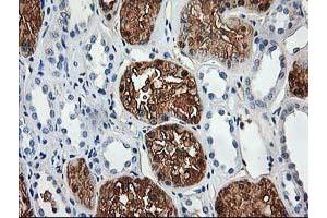 Immunohistochemical staining of paraffin-embedded Human Kidney tissue using anti-ACY1 mouse monoclonal antibody. (Aminoacylase 1 抗体)