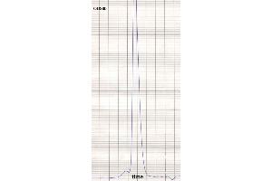 product purity: gel permeation chromatography (Superose 12/HR) (小鼠 anti-人 IgE Antibody (Biotin))