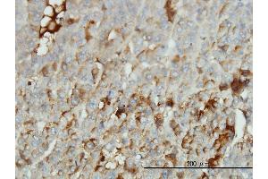 Immunostaining (ISt) image for anti-Albumin (ALB) (AA 19-609) antibody (ABIN559842)