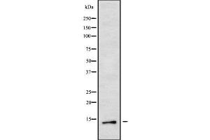 Western blot analysis of MED11 using RAW264. (MED11 抗体  (Internal Region))