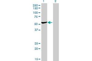 Western Blotting (WB) image for anti-Aspartyl-tRNA Synthetase (DARS) (AA 393-500) antibody (ABIN560561)