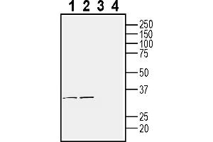 anti-Transmembrane Protein 106B (TMEM106B) (AA 179-194), (Extracellular) antibody