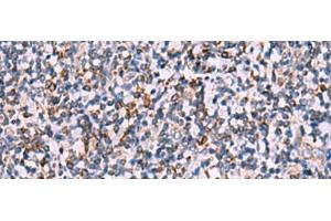 Immunohistochemistry of paraffin-embedded Human tonsil tissue using IPPK Polyclonal Antibody at dilution of 1:30(x200) (IPPK 抗体)
