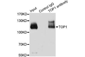 Immunoprecipitation analysis of 200ug extracts of HeLa cells using 3ug TOP1 antibody. (Topoisomerase I 抗体)