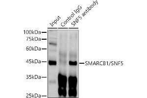 Immunoprecipitation (IP) image for anti-SWI/SNF Related, Matrix Associated, Actin Dependent Regulator of Chromatin, Subfamily B, Member 1 (SMARCB1) (AA 77-376) antibody (ABIN6148107)