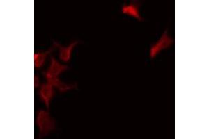 Immunofluorescence (fixed cells) (IF/ICC) image for anti-NADH Dehydrogenase (Ubiquinone) Fe-S Protein 1, 75kDa (NADH-Coenzyme Q Reductase) (NDUFS1) (N-Term) antibody (ABIN6263570)