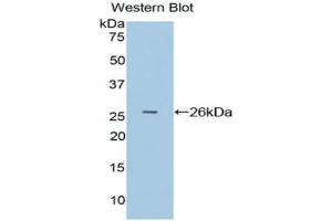 Western blot analysis of the recombinant protein. (APC 抗体  (AA 2634-2842))
