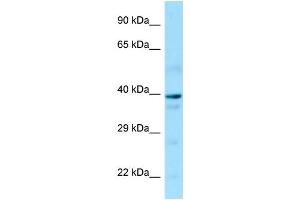 Western Blotting (WB) image for anti-Guanine Nucleotide Binding Protein (G Protein), alpha 14 (GNa14) (N-Term) antibody (ABIN2790107) (GNa14 抗体  (N-Term))