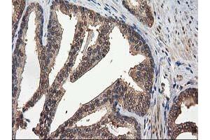 Image no. 12 for anti-Destrin (Actin Depolymerizing Factor) (DSTN) antibody (ABIN1497910) (Destrin 抗体)