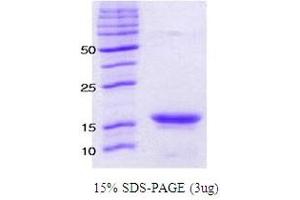 Figure annotation denotes ug of protein loaded and % gel used. (alpha Synuclein A53T (active) 蛋白)