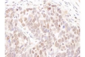 anti-Casein Kinase 2 alpha 1 (CSNK2A1) (C-Term) antibody