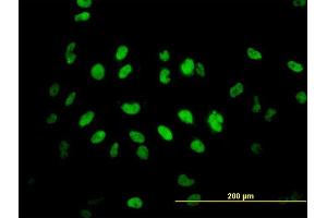 Immunofluorescence of monoclonal antibody to TLK2 on HeLa cell. (TLK2 抗体  (AA 1-126))