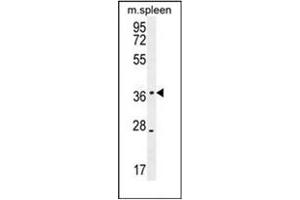 Western blot analysis of KLHDC1 Antibody (N-term) in mouse spleen tissue lysates (35ug/lane). (KLHDC1 抗体  (N-Term))