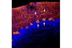 Expression of AGTR1 in rat cerebellum - Immunohistochemical staining of perfusion-fixed frozen rat brain sections using Anti-Angiotensin II Receptor Type-1 (extracellular)-ATTO Fluor-550 Antibody (ABIN7042923), (1:60).