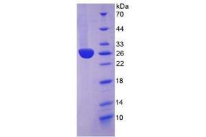 Image no. 1 for C-Reactive Protein (CRP) (AA 21-225) protein (His tag) (ABIN1098914) (CRP Protein (AA 21-225) (His tag))