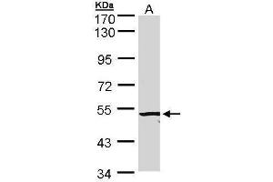 Western Blotting (WB) image for anti-Activin A Receptor Type II-Like 1 (ACVRL1) (C-Term) antibody (ABIN2857028)