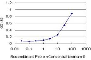 Detection limit for recombinant GST tagged PDHB is approximately 1ng/ml as a capture antibody. (PDHB 抗体  (AA 250-359))