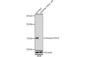 Western blot analysis of extracts from normal (control) and Histone H2A. (Histone H2A 抗体  (AA 1-128))