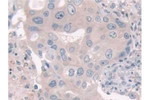 Immunohistochemistry (IHC) image for anti-USP6 N-terminal Like (USP6NL) (AA 1-292) antibody (ABIN7430093)