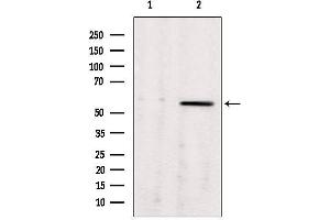 Western blot analysis of extracts from rat brain, using ALDH7A1 antibody. (ALDH7A1 抗体  (C-Term))