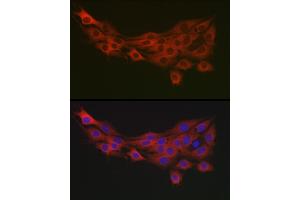 Immunofluorescence analysis of PC-12 cells using PDK1/PDHK1 Rabbit pAb (ABIN3015351, ABIN3015352, ABIN1681301, ABIN5663787 and ABIN6214001) at dilution of 1:100 (40x lens). (PDPK1 抗体  (AA 1-150))