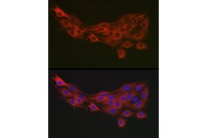 Immunofluorescence analysis of PC-12 cells using PDK1/PDHK1 Rabbit pAb (ABIN3015351, ABIN3015352, ABIN1681301, ABIN5663787 and ABIN6214001) at dilution of 1:100 (40x lens).