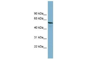 WB Suggested Anti-PGM3 Antibody Titration: 0. (Phosphoglucomutase 3 抗体  (Middle Region))