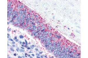 Immunohistochemistry (IHC) image for anti-Corticotropin Releasing Hormone Receptor 2 (CRHR2) (N-Term) antibody (ABIN1048468)