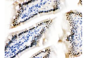 ZBTB7A was detected in paraffin-embedded sections of mouse intestine tissues using rabbit anti- ZBTB7A Antigen Affinity purified polyclonal antibody at 1 μg/mL. (ZBTB7A 抗体  (N-Term))