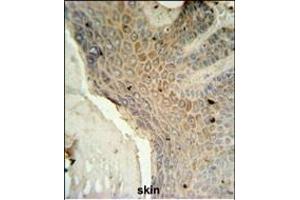 MFSD3 Antibody (Center) (ABIN651438 and ABIN2840241) IHC analysis in formalin fixed and paraffin embedded human skin tissue followed by peroxidase conjugation of the secondary antibody and DAB staining. (MFSD3 抗体  (AA 174-202))