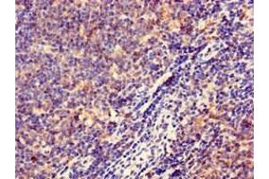 Immunohistochemistry of paraffin-embedded human lymph node tissue using ABIN7155597 at dilution of 1:100 (HLA-DQB1 抗体  (AA 128-175))