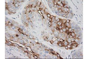 Image no. 1 for anti-BAI1-Associated Protein 2 (BAIAP2) antibody (ABIN1496805) (BAIAP2 抗体)