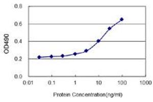 FCER1A (Human) Matched Antibody Pair