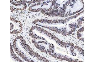 IHC analysis of HnRNP H/HNRNPH1 using anti-HnRNP H/HNRNPH1 antibody (ABIN4886623). (HNRNPH1 抗体  (N-Term))
