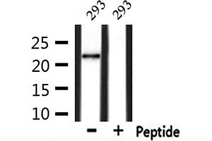Western blot analysis of extracts from 293, using GPX4 Antibody. (GPX4 抗体  (C-Term))