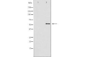 Western blot analysis of extracts from HuvEc cells, using GBA3 antibody. (GBA3 抗体  (Internal Region))