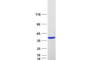 Western Blotting (WB) image for Sulfotransferase Family, Cytosolic, 2A, Dehydroepiandrosterone (DHEA)-Preferring, Member 1 (SULT2A1) protein (Myc-DYKDDDDK Tag) (ABIN2732969)