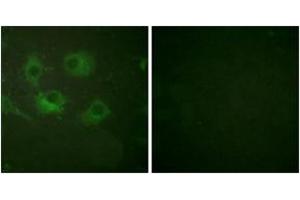 Immunofluorescence analysis of HuvEc cells, using Claudin 3 Antibody. (Claudin 3 抗体  (AA 171-220))