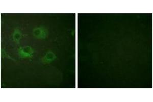 Immunofluorescence analysis of HuvEc cells, using Claudin 3 Antibody. (Claudin 3 抗体  (AA 171-220))
