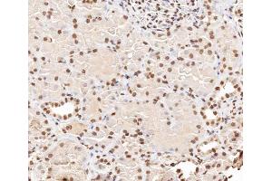 ABIN6267406 at 1/200 staining human kidney tissue sections by IHC-P. (Stathmin 1 抗体  (pSer38))