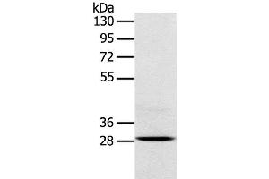 Western Blot analysis of Mouse brain tissue using TREM2 Polyclonal Antibody at dilution of 1:250 (TREM2 抗体)