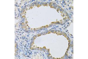 Immunohistochemistry of paraffin-embedded mouse lung using AP2B1 Antibody (ABIN1871002) at dilution of 1:100 (40x lens). (AP2B1 抗体)