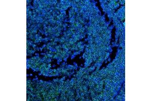 IF analysis of CD45 using anti-CD45 antibody (ABIN7602775).