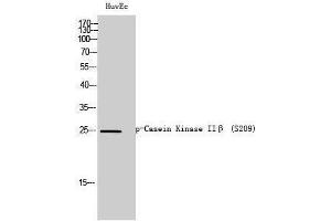 Western Blotting (WB) image for anti-Casein Kinase 2, beta (CSNK2B) (pSer209) antibody (ABIN3173273) (CSNK2B 抗体  (pSer209))