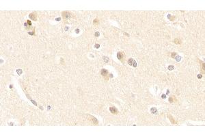 Detection of GLS in Human Cerebrum Tissue using Polyclonal Antibody to Glutaminase (GLS) (Glutaminase 抗体  (AA 221-533))