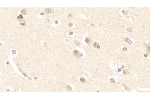 Detection of GLS in Human Cerebrum Tissue using Polyclonal Antibody to Glutaminase (GLS)