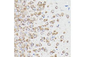 Immunohistochemistry (IHC) image for anti-Eukaryotic Translation Elongation Factor 1 alpha 1 (EEF1A1) (AA 123-462) antibody (ABIN7267022)